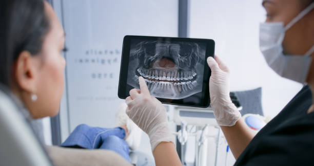 Licensed Tooth Extraction service in Cameron Parish County, LA - Smile Center Dentistry